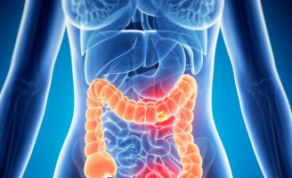 5 loại thực phẩm càng ăn nhiều càng dễ mắc ung thư ruột