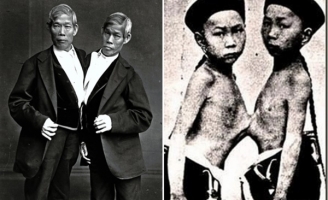 Cặp sinh đôi dính liền nổi tiếng nhất lịch sử: Bị gọi là “quái vật” nhưng vẫn thành công rực rỡ