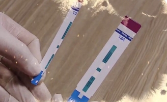 Cắt đôi que xét nghiệm HIV, bớt xén vật tư nguy hiểm thế nào?