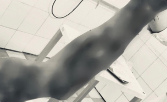 Rùng mình với khuôn mặt dập nát của người đàn ông do đốt pháo tự chế