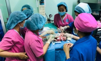 Sẵn sàng cho ca mổ tách dính 2 bé gái 