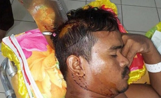 Vợ chồng cãi nhau quăng dao rựa qua cửa sổ, không may rơi trúng đầu người hàng xóm xấu số